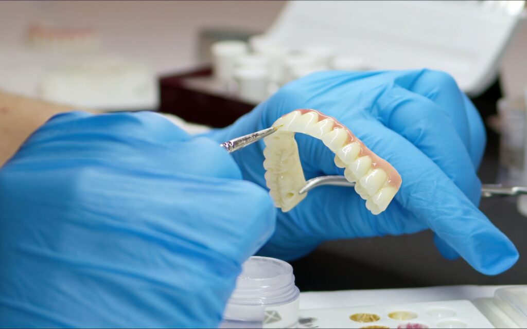 Quanto ci vuole per rifare i denti?