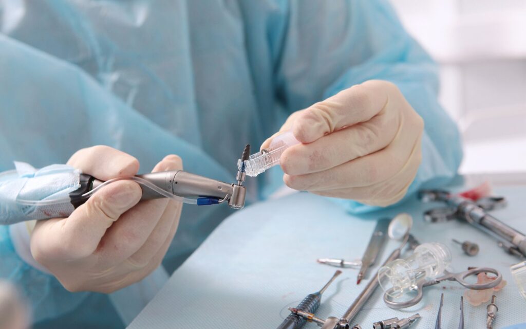 Quanto tempo ci vuole per fare un impianto dentale? Tempistiche reali dei trattamenti di implantologia