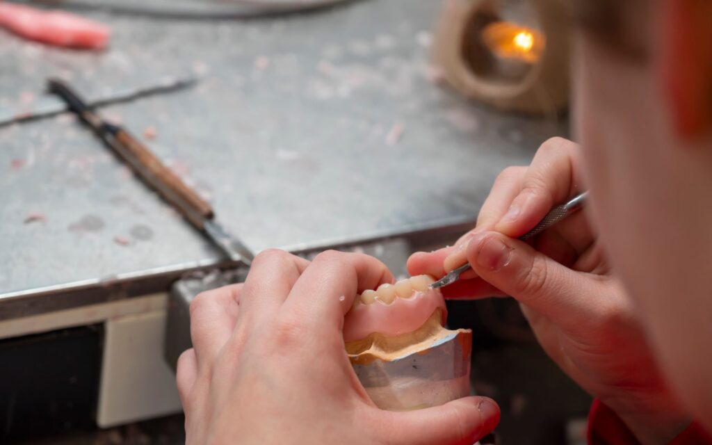Impianti dentali in composito: perché è una delle soluzioni più scelte